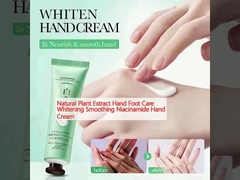 Chiết xuất thực vật tự nhiên chăm sóc bàn tay chân làm trắng làm mềm Niacinamide kem tay